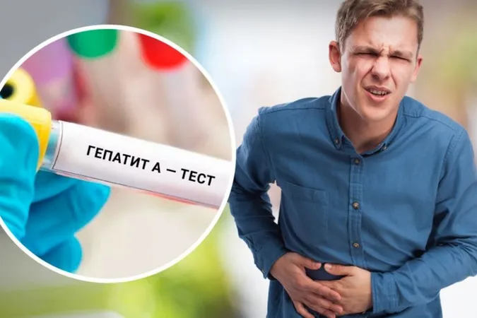 У селі на Волині зафіксували спалах гепатиту А