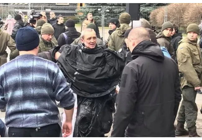 Самопідпал під офісом Зеленського: повідомили про стан постраждалого