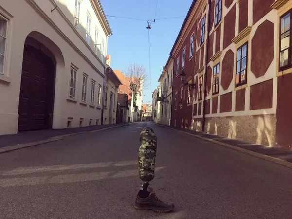 Атовець руйнує стереотипи та фотографує протез ноги в Instagram