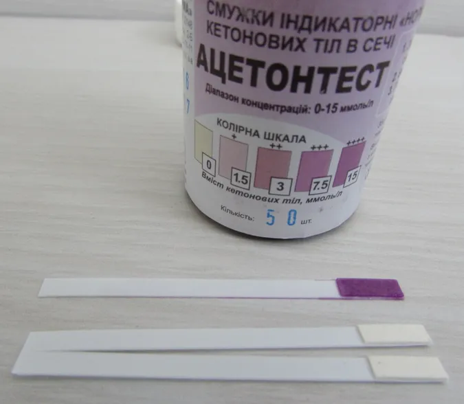 «Фіолетова» хвороба: луцька лікарка розповіла про підвищений ацетон у дітей