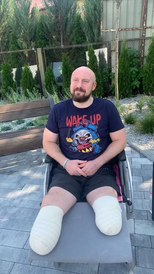 «Якби не дружина, я б цього не витягнув»: історія ветерана з Луцька Тараса Сасовського