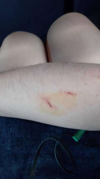 «Де поділа чоловіка»: у Луцьку дружина пацієнта побила медсестру (фото)