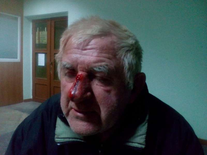 Попросили закурити і побили: в Луцьку вночі напали на дідуся