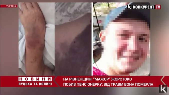Жінка, побита сином директора Рівненської АЕС, померла (відео)