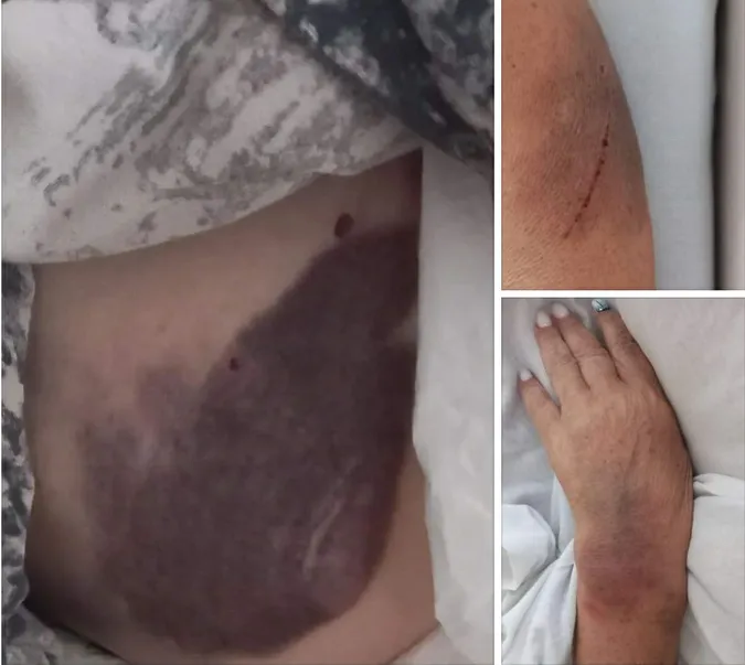 Син директора Рівненської АЕС побив жінку похилого віку,  – ЗМІ (відео)