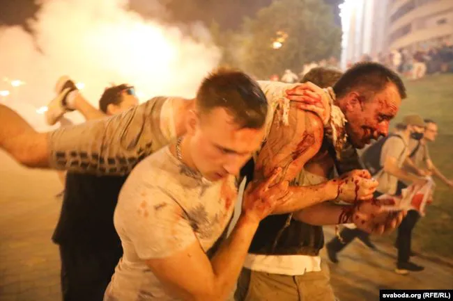 Натовп, кров, дим: протест у Білорусі (фото 18+)