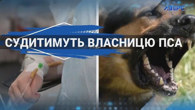 Власницю бійцівського пса, який покусав 7-річну дівчинку в Іваничах, судитимуть