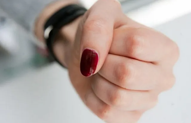 Біля магазину у Луцьку підприємиця проламала череп однокласниці: що вирішив суд