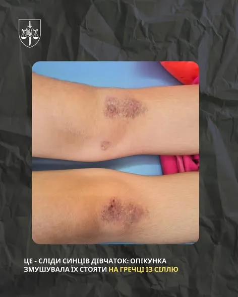 Дві доби на колінах без їжі: на Полтавщині опікунка катувала неповнолітніх сестер