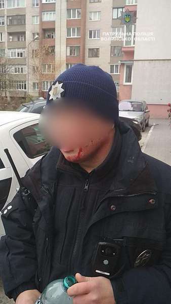 У Луцьку психічно хворий чоловік побив патрульного (фото)