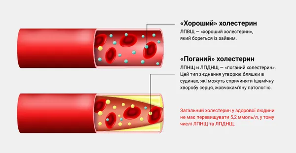 Яка норма холестерину у чоловіків та жінок