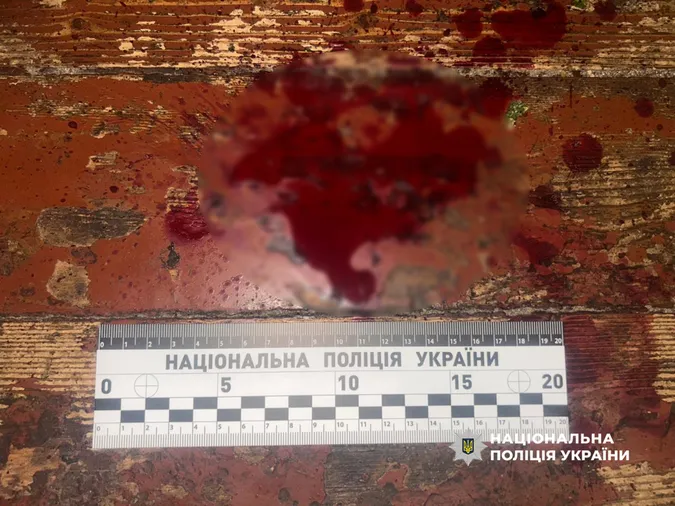 Кривава сварка на Рівненщині: чоловіка затримали за напад на сусіда (фото)