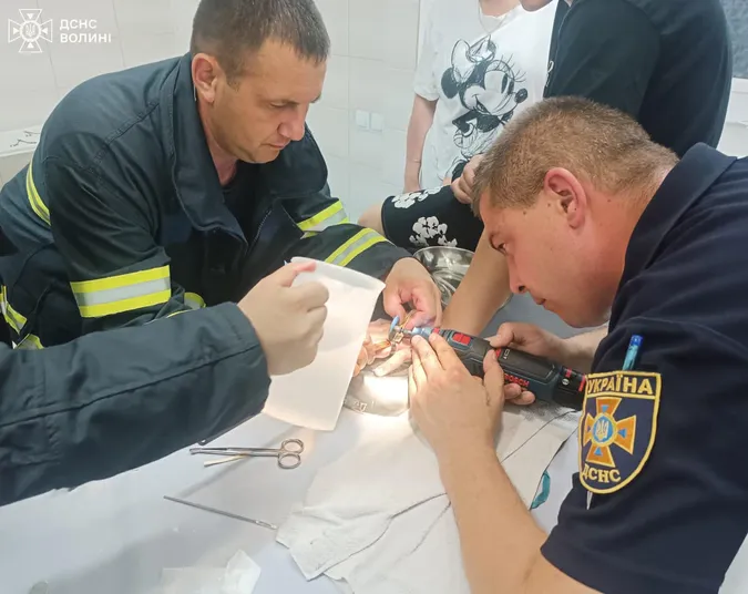 У Луцьку рятувальники допомагали хлопцю зняти перстень з пальця (фото)