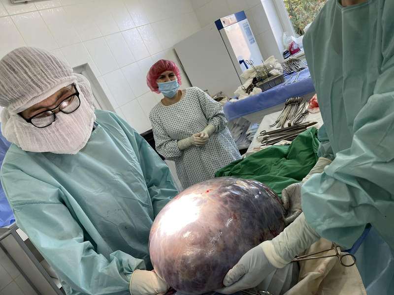 У Волинському онкоцентрі жінці видалили пів метрову пухлину вагою 30 кілограмів (фото 18+)