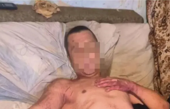 Кривава драма на Закарпатті: чоловік вбив жінку, а потім відрізав собі статевий орган