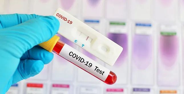 За добу на Волині – 37 нових випадків COVID-19: де реєстрували
