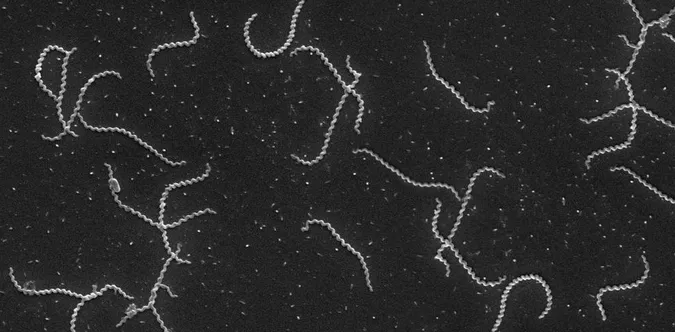 Бактерія Leptospira під мікроскопом