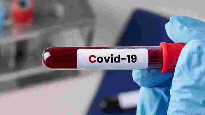 За тиждень на COVID-19 захворіли 20 волинян, восьмеро з них – діти