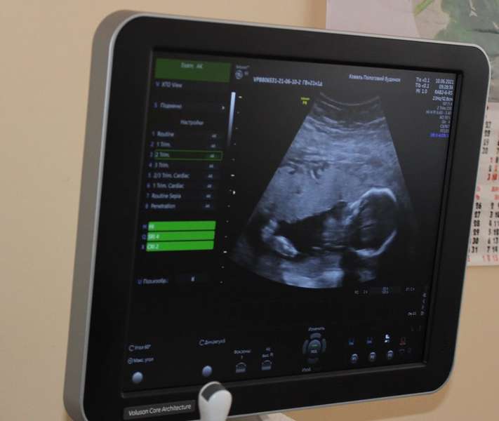 У Ковелі УЗД-апарат може зробити фото малюка ще до народження (фото)