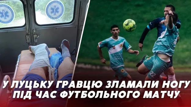 У Луцьку футболісту зламали ногу під час матчу (відео)