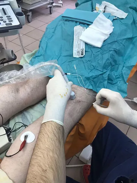 Анестезія під контролем УЗД: у луцькій лікарні запровадили нову методику (фото)