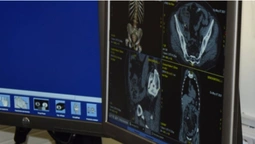 У Любомльському ТМО запрацював високоточний томограф (фото)