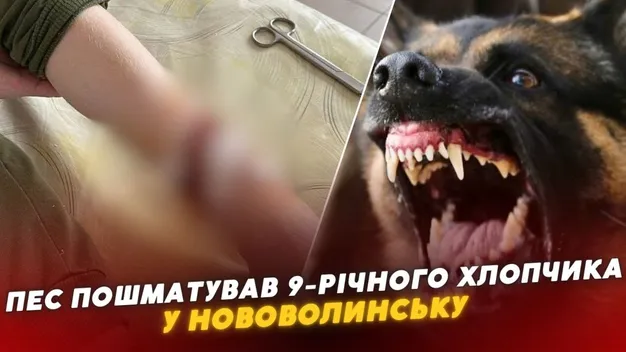 У Нововолинську безпритульний собака покусав 9-річного хлопчика: що каже мер (відео)