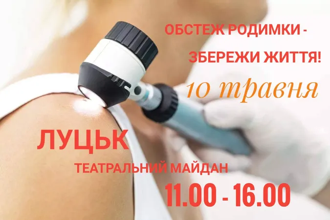 Лучани зможуть безплатно перевірити родимки