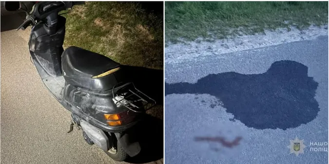 🛵Забрали з переломами: на Камінь-Каширщині п'яний скутерист впав серед дороги (фото)