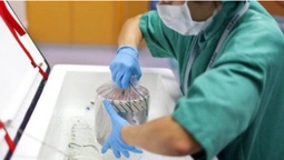 За рік у Волинській обласній лікарні пересадили 26 органів (відео)
