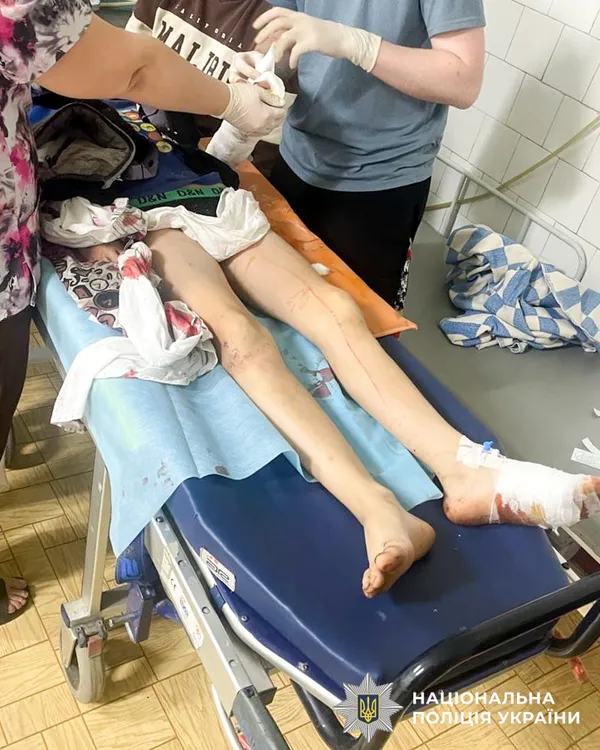 На Рівненщині собаки напали на дітей: як покарають власника (фото)