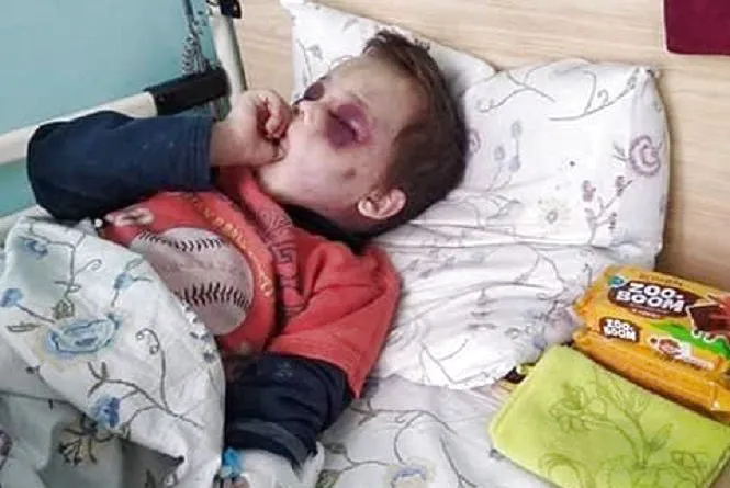 У Нововолинську батько побив сина – він у лікарні