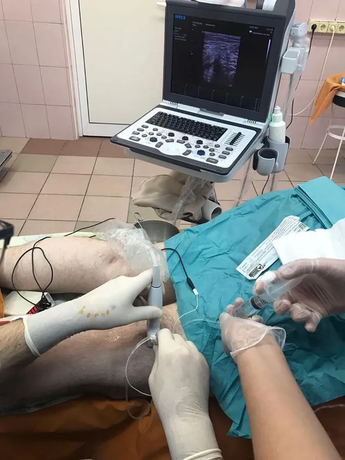 Анестезія під контролем УЗД: у луцькій лікарні запровадили нову методику (фото)