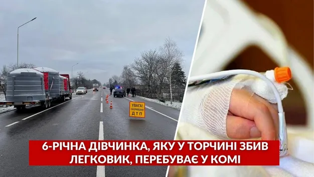 Шестирічна дівчинка, яка потрапила під колеса авто в Торчині, перебуває у комі (відео)
