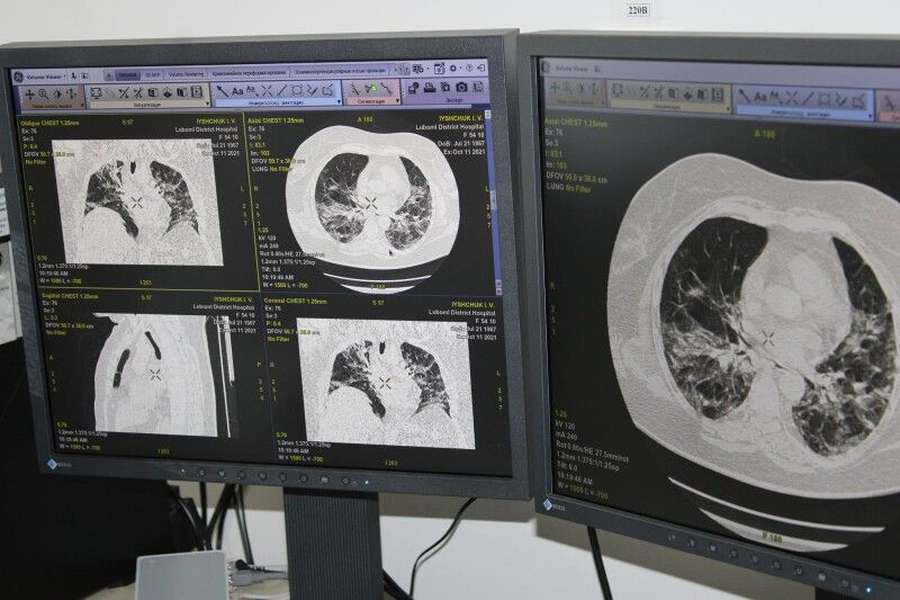 Для Любомльської лікарні придбали комп'ютерний томограф (фото)