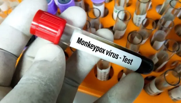 У 27 країнах світу підтвердили 780 випадків мавпячої віспи