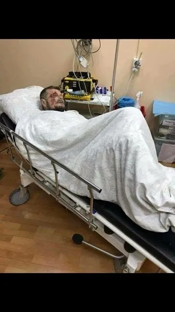 Двоє загиблих і поранений депутат Мосійчук: подробиці вибуху в Києві 