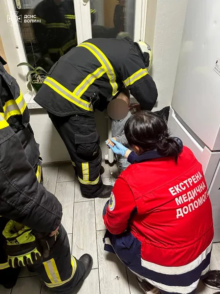 У Луцьку рятувальники визволили руку 3-річної дитини, яка застрягла в батареї (фото)