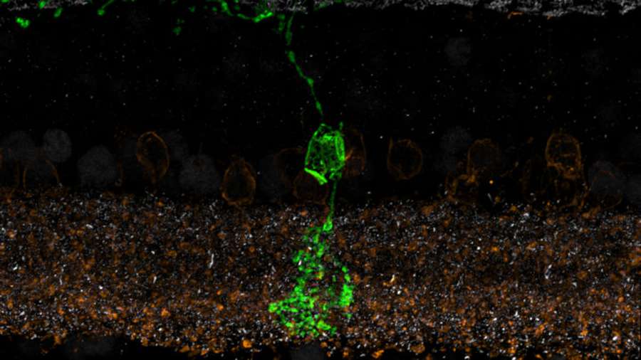 Дослідники виявили новий тип нервових клітин у сітківці ока (фото)