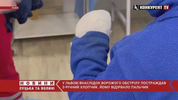 Хлопчику відірвало пальчик: що відомо про поранених внаслідок ракетних ударів у Львові (відео)