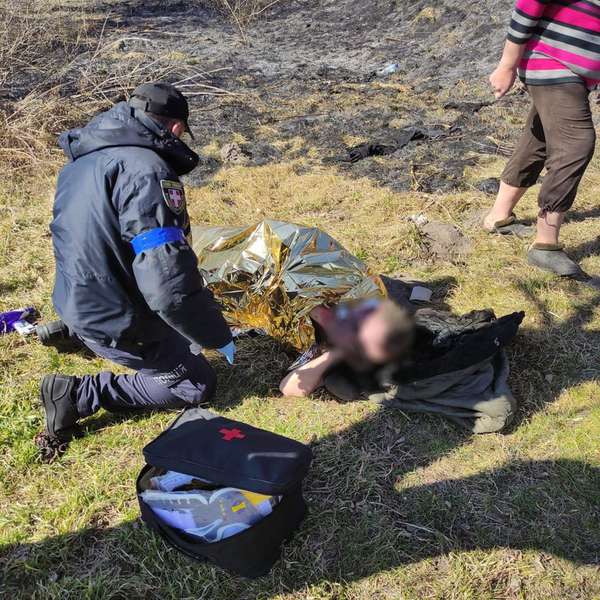 У селі під Луцьком загорівся чоловік, який кинув недопалок у траву (фото)