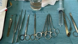 У Волинській обласній лікарні виконали першу трансплантацію