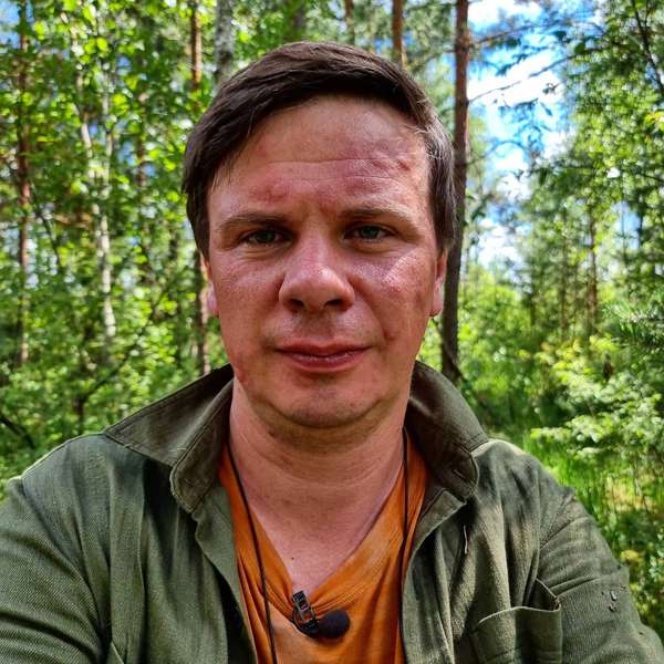 Дмитро Комаров показав, що з ним зробили волинські комарі (фото)