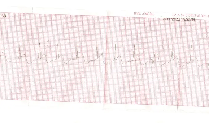 На Волині медики «швидкої» «відкачали» пацієнта з інфарктом (фото)