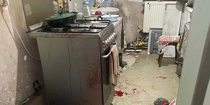На Тернопільщині в руках чоловіка здетонувала міна, яку він знайшов на городі (фото)