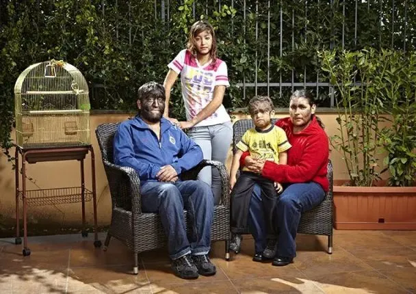 Найволохатіша сім'я у світі: неймовірна історія «чоловіка-вовка» та його рідних (фото)