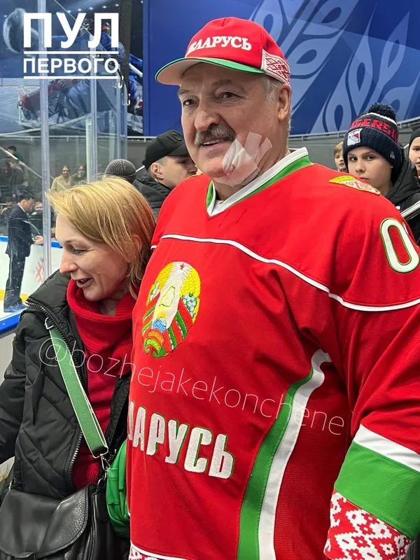 лукашенко отримав ключкою по обличчю під час хокейного матчу (відео)
