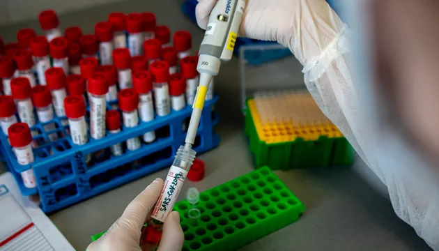 В Україні – понад 6 500 нових хворих на COVID-19, на Волині – 316
