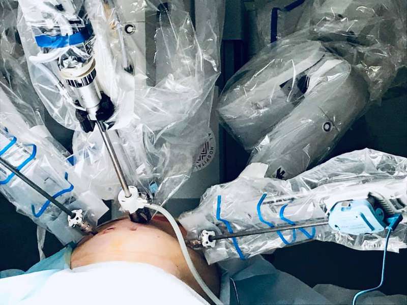 У львівській лікарні, яку очолює волинянин, робот прооперував людину (фото 18+)