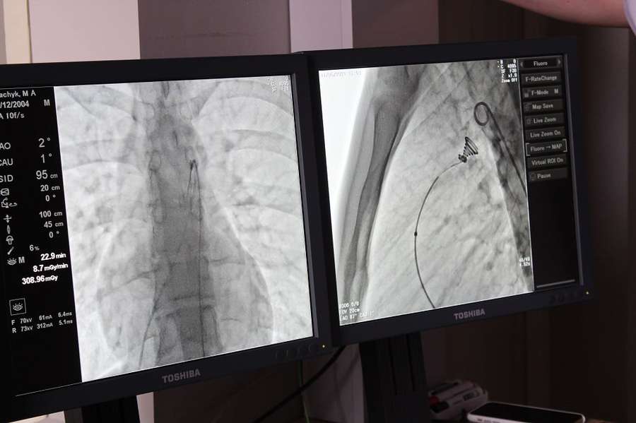 У Ковелі хлопцю з вадою серця зробили операцію без розрізів (фото)